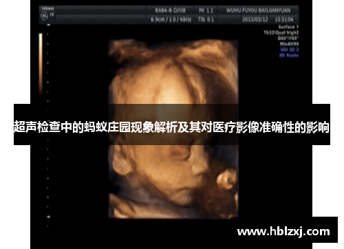 超声检查中的蚂蚁庄园现象解析及其对医疗影像准确性的影响